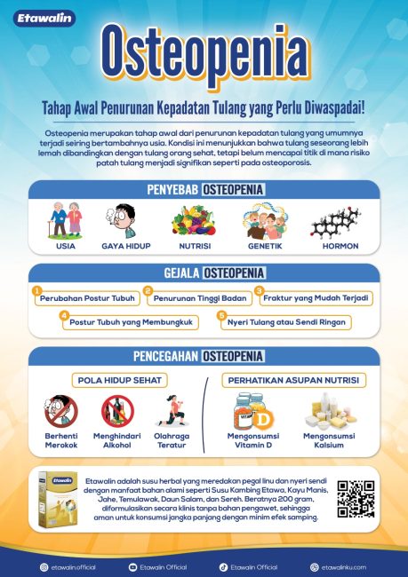 Osteopenia: Tahapan Awal Penurunan Kepadatan Tulang yang Perlu Diwaspadai